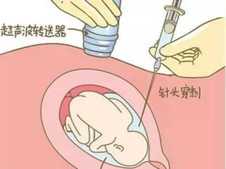 胎儿能做亲子鉴定（做胎儿亲子鉴定。费用多少钱。）