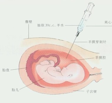 怀孕几个月能做胎儿亲子鉴定（宝宝在肚子里可以做亲子鉴定吗）